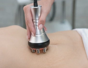 RF лифтинг тела