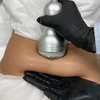 RF лифтинг тела